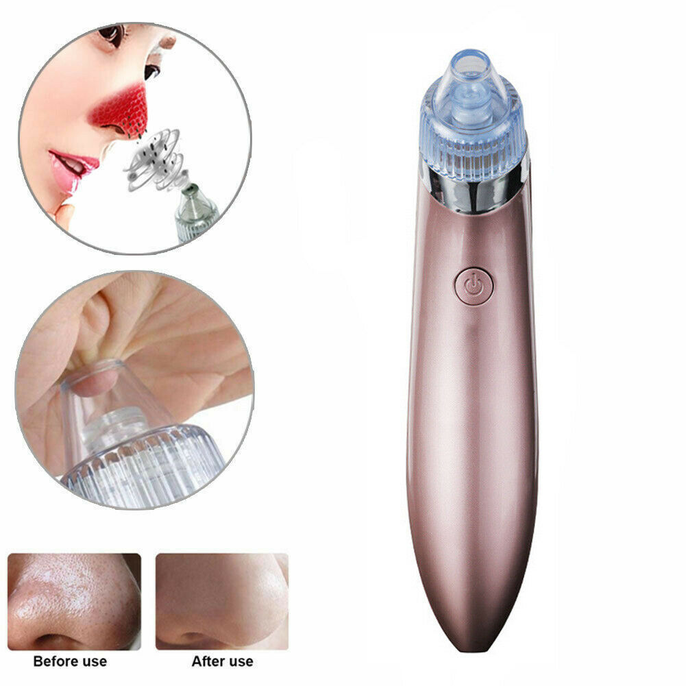 Blackhead Remover Vacuum - Professional Pore Cleaner with 4 Suction Heads