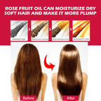 Organic Rosehip Oil - Multi-Purpose Face, Body & Hair Moisturizer for Dry Skin & Anti-Aging