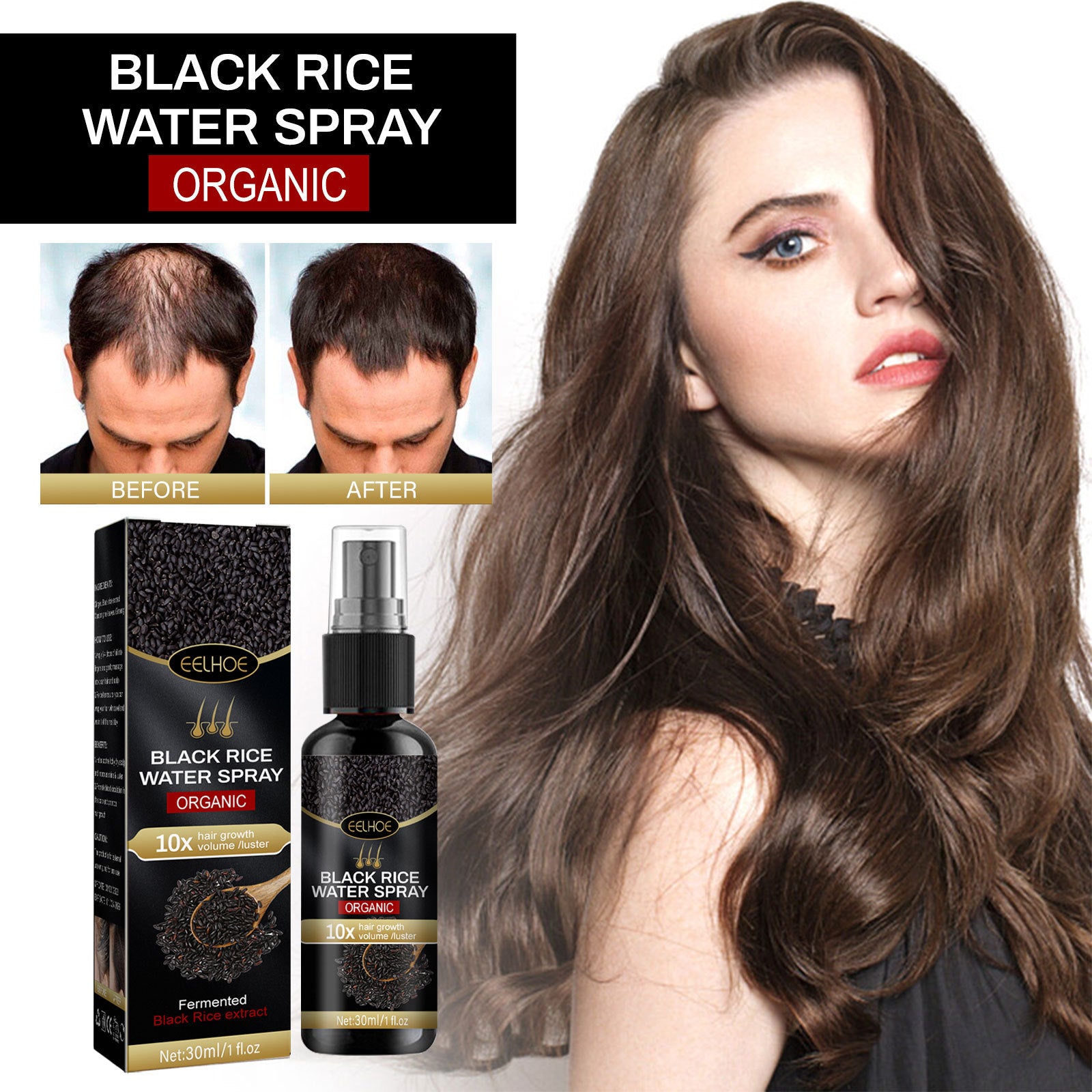 Black Rice Hair Growth Spray – Scalp Treatment with Ginger & Ginseng for Thicker Hair