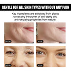 Instant Face Firming Serum | Anti-Aging Wrinkle Reducer with Hyaluronic Acid & Vitamin C