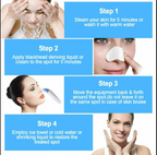 Blackhead Remover Vacuum | Professional Pore Cleaner with 4 Suction Heads