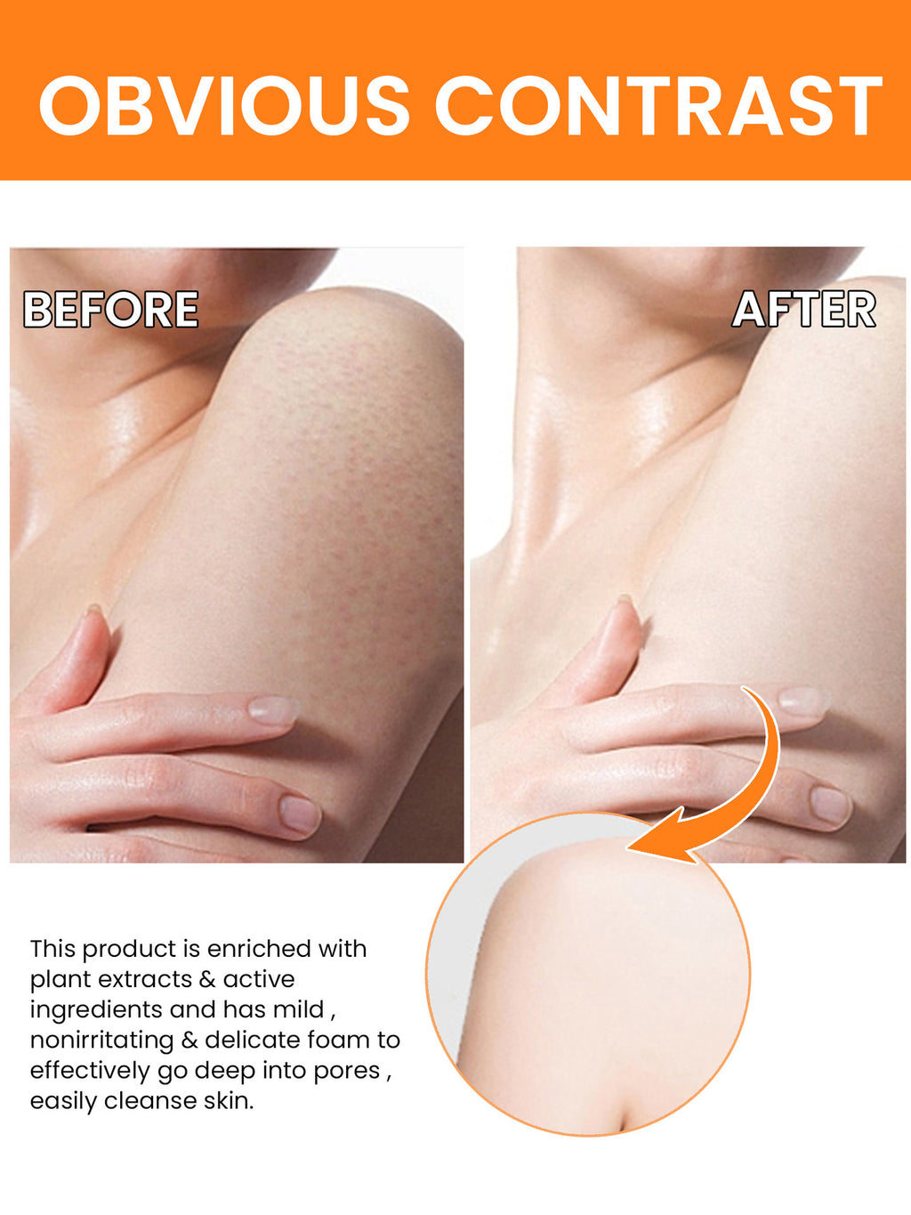 Turmeric Face Serum for Dark Spots (30ml) | Brightening & Anti-Aging