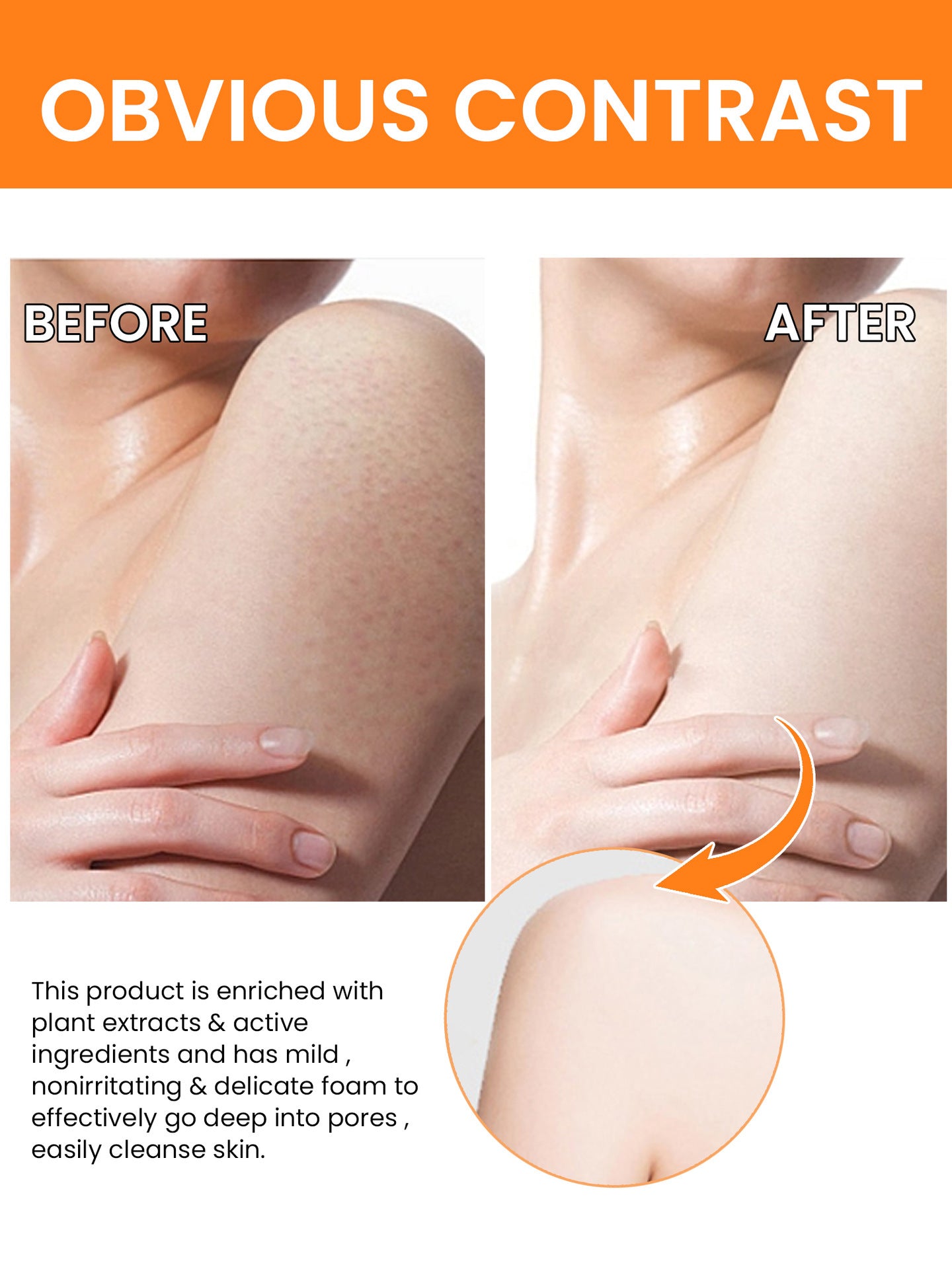Turmeric Face Serum for Dark Spots (30ml) | Brightening & Anti-Aging