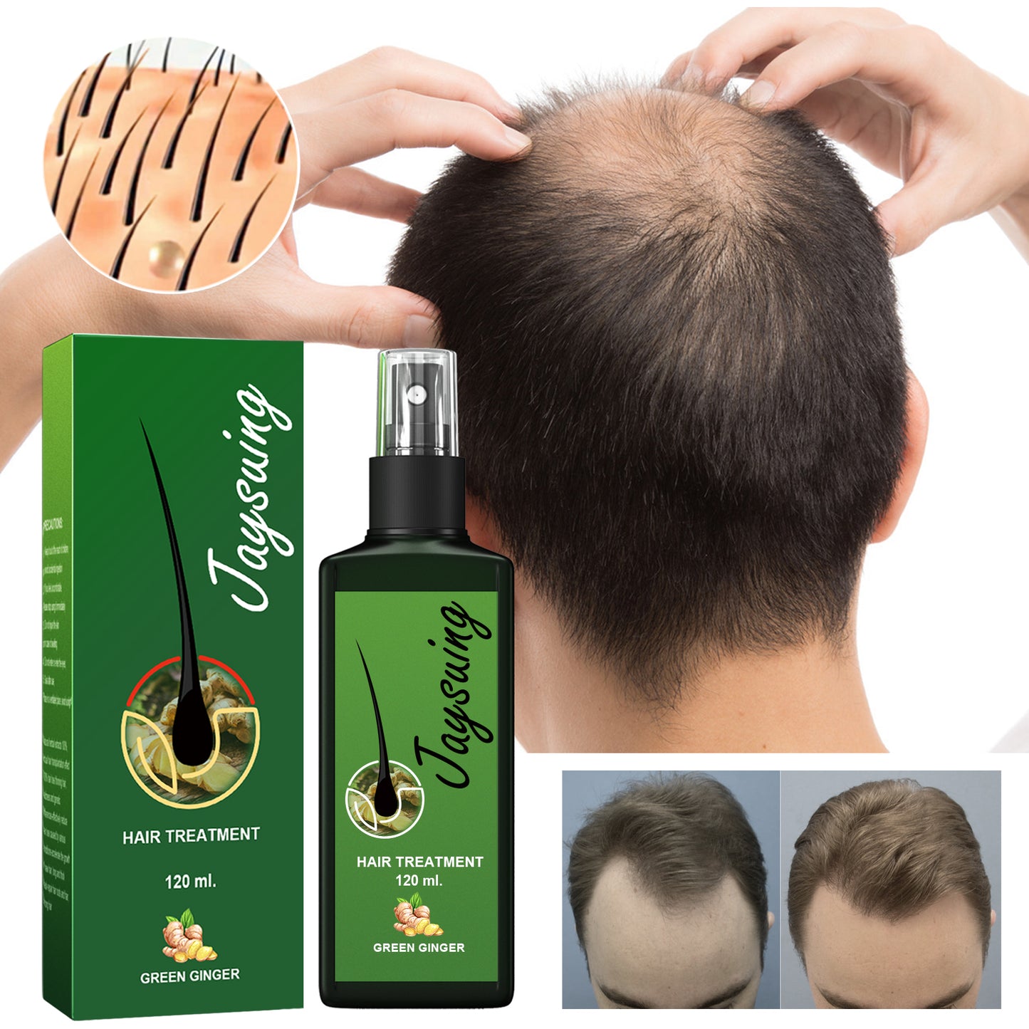 Ginger Hair Growth Spray – Reduces Hair Loss & Promotes Thicker, Stronger Hair – 120ml