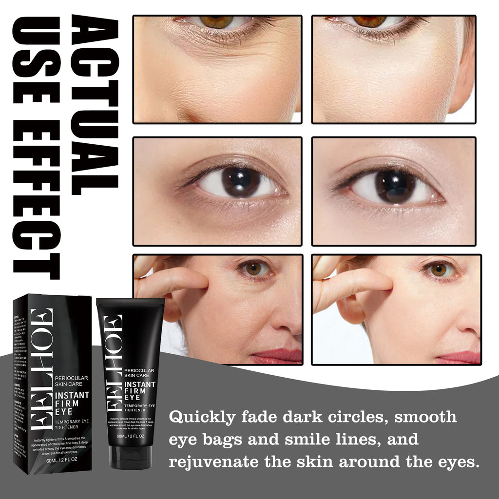Anti-Aging Eye Cream with Hyaluronic Acid & Collagen – Firms, Brightens & Reduces Wrinkles