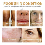 Turmeric Dark Spot Corrector Serum – Brightening Face Treatment for Even Skin Tone & Radiance