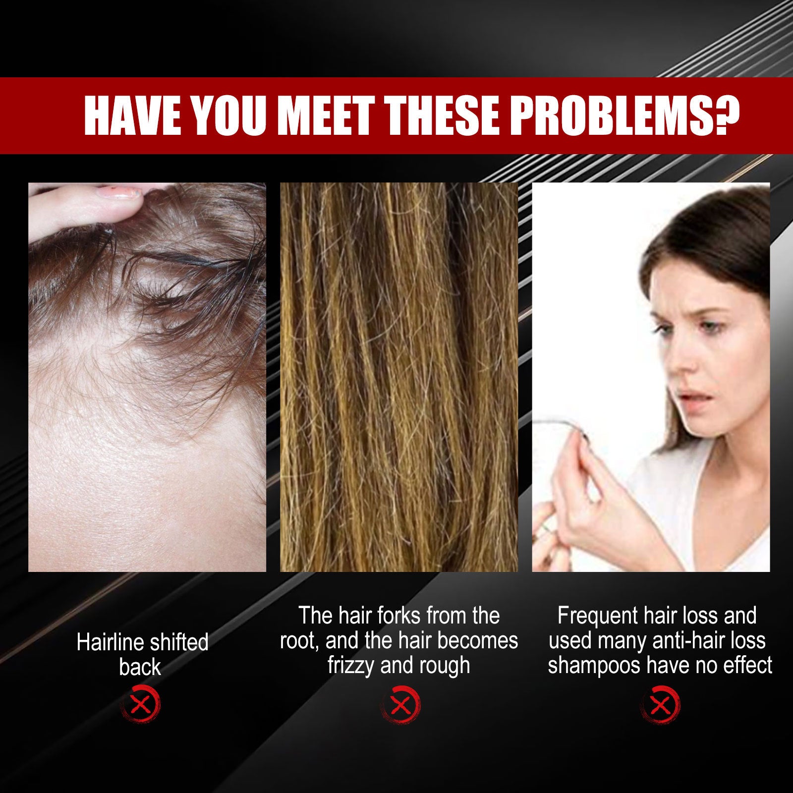 Black Rice Hair Growth Spray – Scalp Treatment with Ginger & Ginseng for Thicker Hair