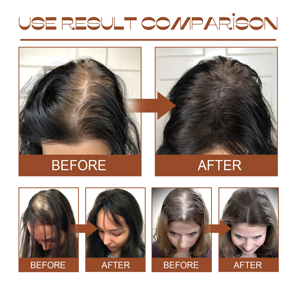 Batana Oil Deep Conditioning Treatment – Thicker, Stronger & Shinier Hair | All Hair Types