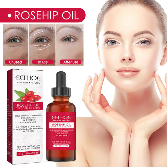 Organic Rosehip Oil - Multi-Purpose Face, Body & Hair Moisturizer for Dry Skin & Anti-Aging