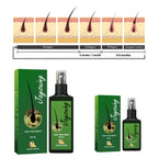 Ginger Hair Growth Spray – Reduces Hair Loss & Promotes Thicker, Stronger Hair – 120ml