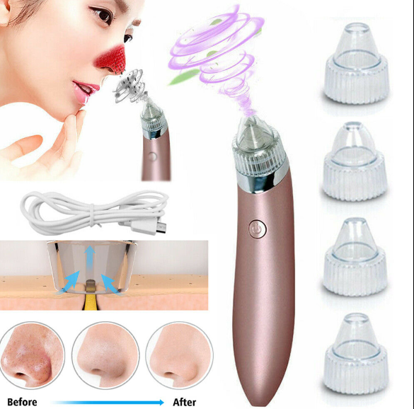Blackhead Remover Vacuum | Professional Pore Cleaner with 4 Suction Heads